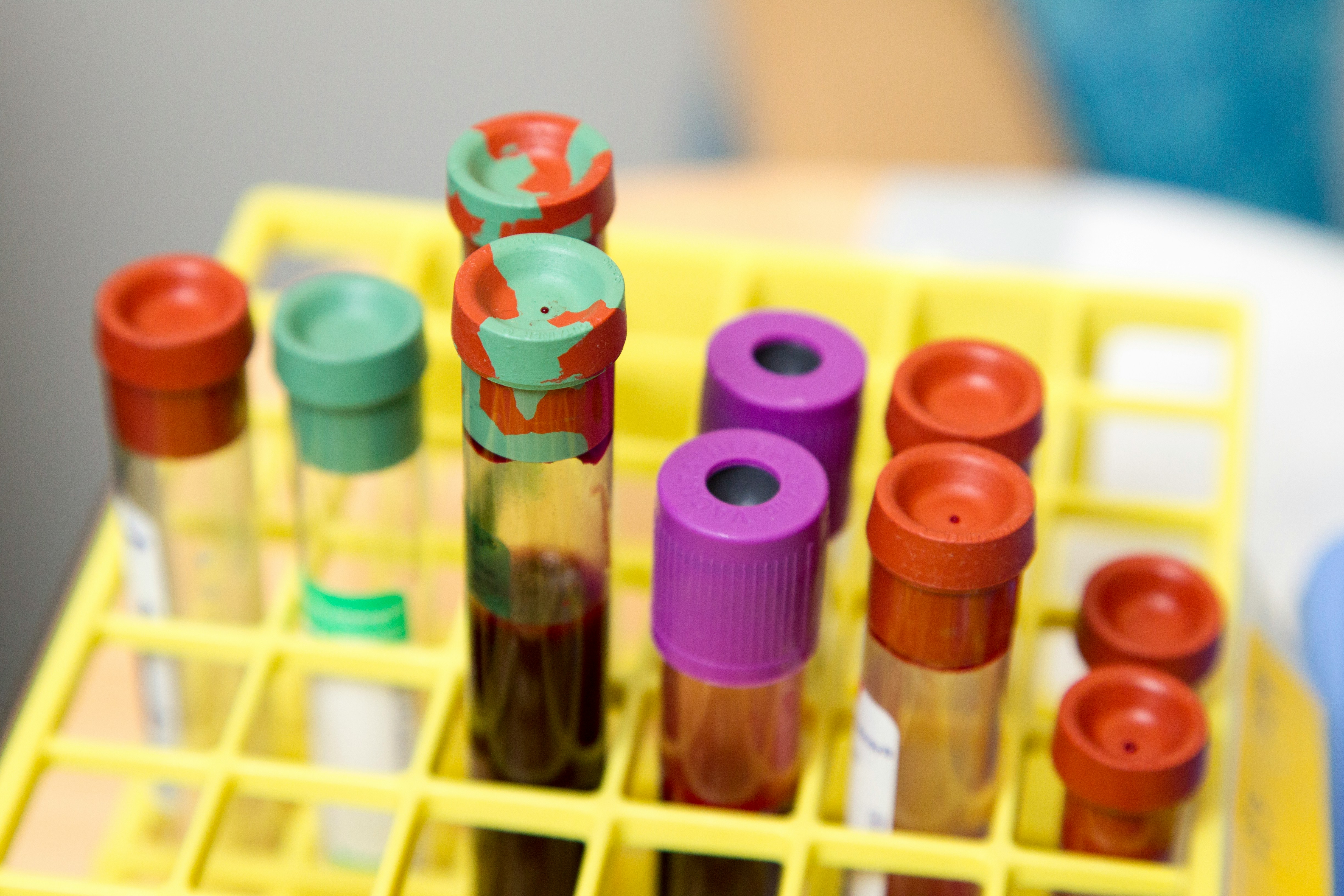Lab Testing