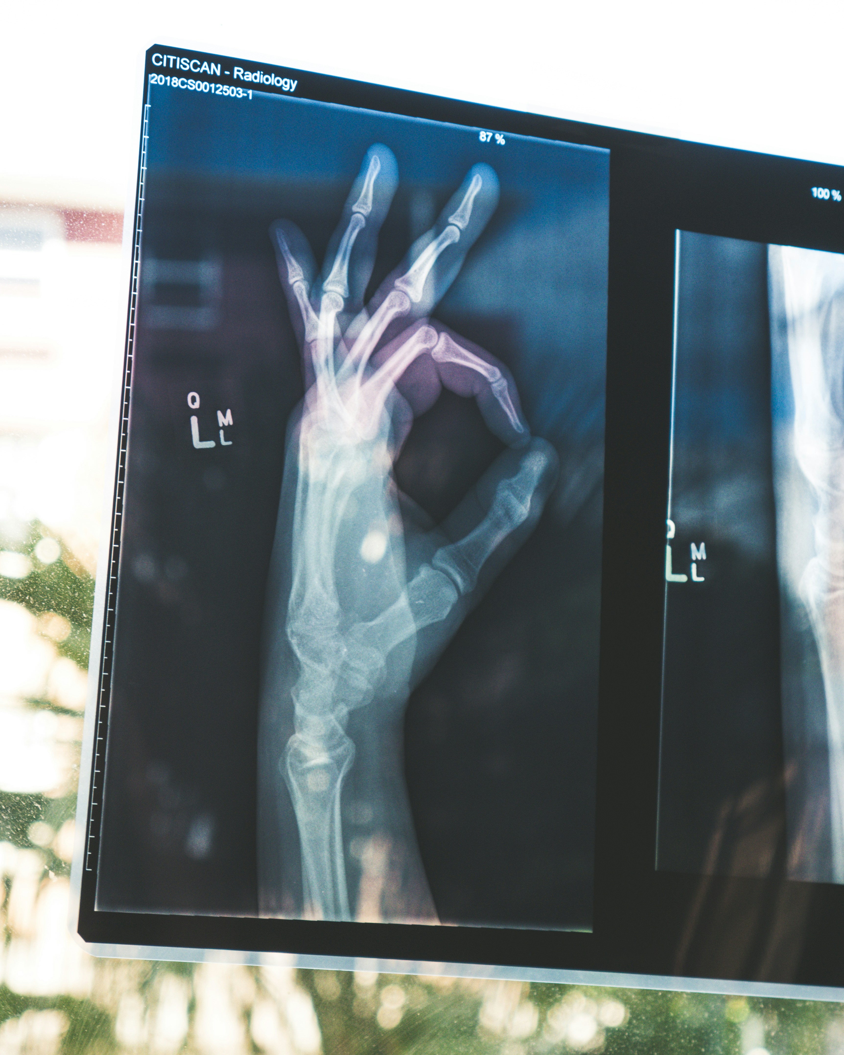 X-ray Imaging